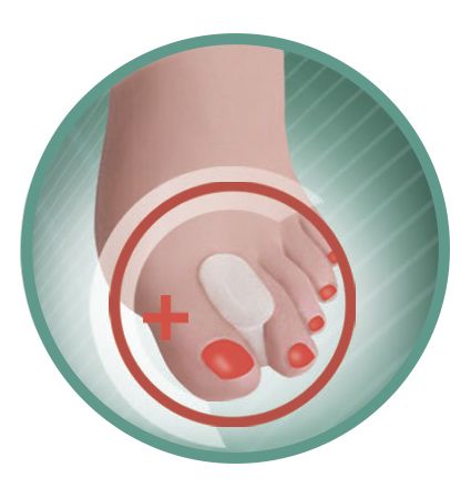 Межпальцевый разделитель S19-15 Sursil-Ortho силиконовый, пара купить в OrtoMir24